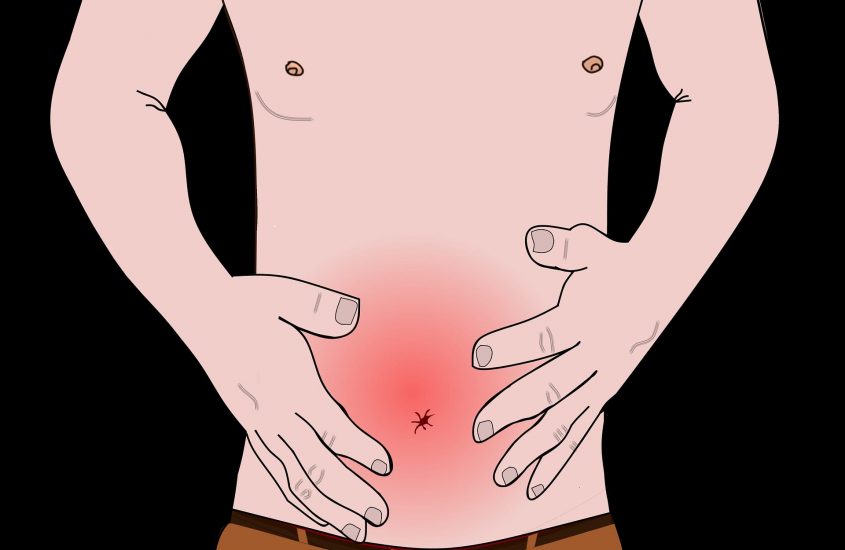 Sindrome dell’intestino irritabile (IBS): continuiamo a parlarne